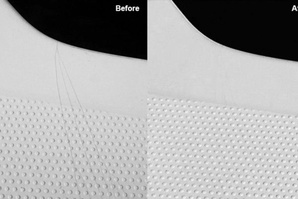 before-after-5 before-after-5